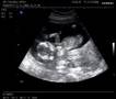 Mommy's unborn baby