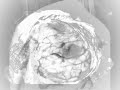 Lobotomy