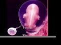 Abortion, is there life?