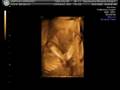 videos de Lauren Nicole Sampson sonogram