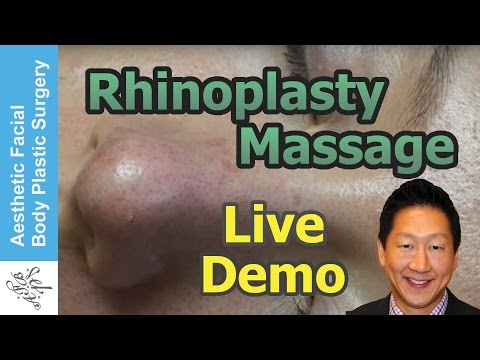how to properly massage nose after rhinoplasty