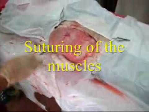 how to perform a c section on a goat