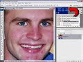 Photoshop Mama's Rosacea Acne Reduction Demo