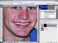 Photoshop Mama's Rosacea Acne Reduction Demo Rosacea