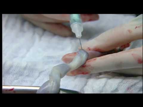 how to obtain umbilical cord blood gas