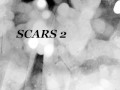 Scars,Jemi,joe
