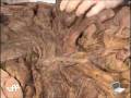 videos de [ANATOMIA] Jejuno e íleo - parte 2   Portal de Vídeo-aulas da UFF.flv
