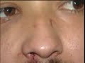 Thieves Use Crowbar to Attack, Carjack Man