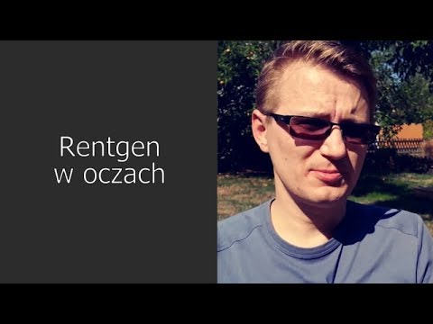 WIDEO. Rentgen w oczach