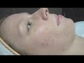 Face Reality Acne & Skin Care Clinic