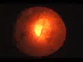 Pyrolysis, Gasification and Plasma Incineration: Part 3