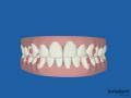 videos de ClinCheck - Centre
