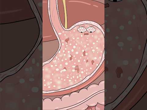 What Happens If You Take Painkillers on an Empty Stomach?  #shorts