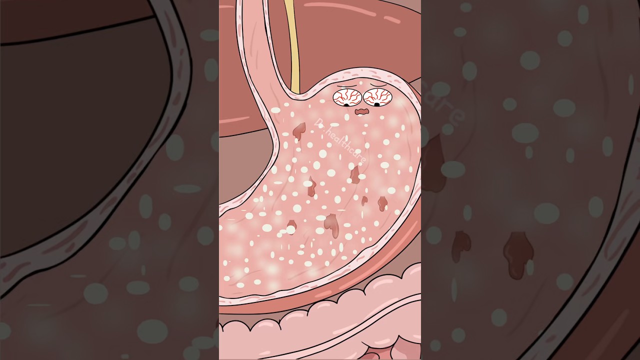 What Happens If You Take Painkillers on an Empty Stomach?  #shorts