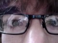 My Congenital Nystagmus and Astigmatism