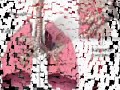 They Are All Types of Cancer.wmv