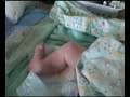 spina-bifida-baby-moving-his-leg-for-the-first-time.html