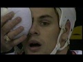 Dustin Browns Greatest Hits