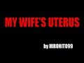 hysteroscopy-endometrial-polyp.html