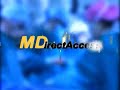 Robotic Coronary Artery Bypass Surgery Heart Bypass Surgery