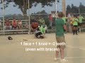 Kendra's home plate softball collision