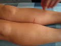 Skolerne for Idr�tsmassage  Downing-Test for ilium dysfunktion.
