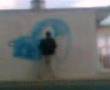 nupre casi torson