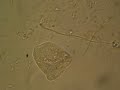 A dan�a da Vorticella