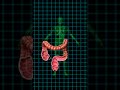 Colorectal Cancer Colon Cancer