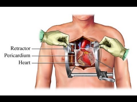 how to perform surgery