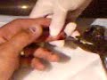 finger nailed - removing the nail - ouch! finger nailed - removing the nail - ouch!
