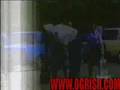 Accidents - Woman