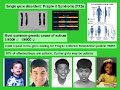 Autism & Genetic Disease