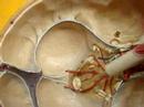Student Narrated: Sinus Veins of the Skull Student Narrated: Sinus Veins of the Skull