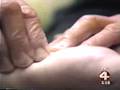 Rolfing Structural Integration at Starkey Laboratories