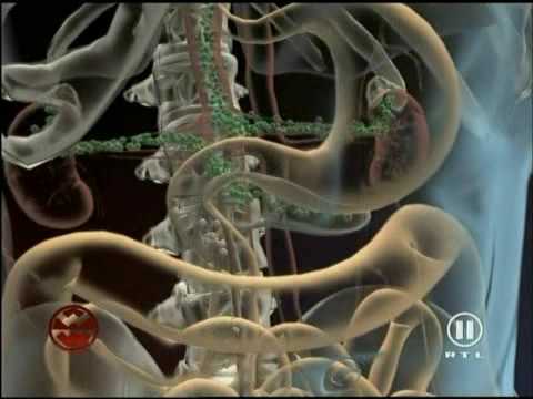 Burnout Syndrom
