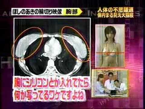 ほしのあきの輪切り映像Youtube(ユーチューブ・ゆーちゅーぶ)・Dailymotion動画