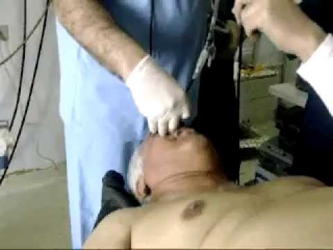 how to perform awake fiberoptic intubation