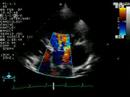 Aortic Regurgitation - Color Doppler Echocardiogram - Dog