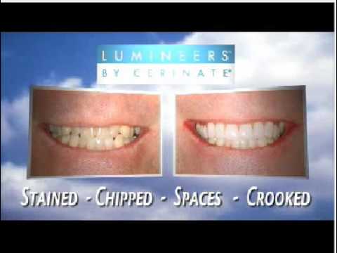 how to whiten lumineers at home