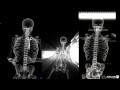 Scanner corporel à rayons X interactif - YouTube
