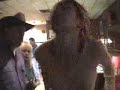 Redneck First Aid- Helping A Chocking Victim Redneck First Aid- Helping A Chocking Victim