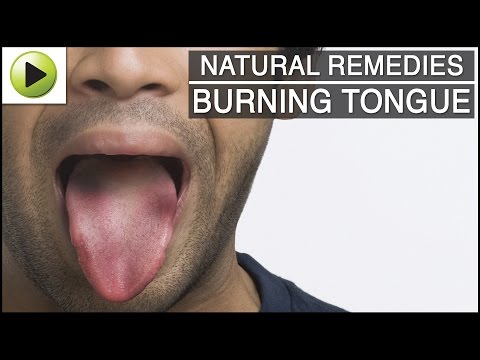 how to cure a burnt tongue