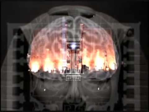 Expand Video Expand Video
