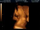3D Ultrasound of Jacob - 8