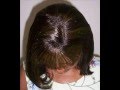 How To Sew A Frontal To A Full Weave