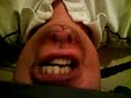 Thumbnail #1