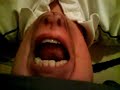 Thumbnail #2