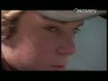 Shark Bites - Man Loses Arm to Shark
