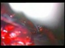 Thumbnail #2